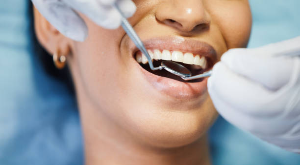 Best Emergency Dental Care for Trauma or Injury in Vance, AL